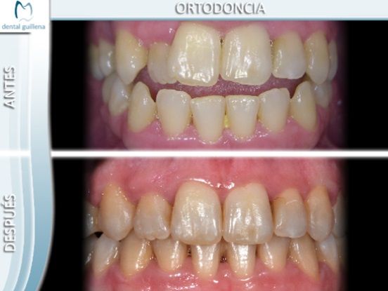 Ortodoncia 4