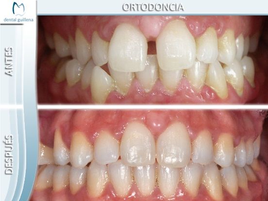 Ortodoncia 1