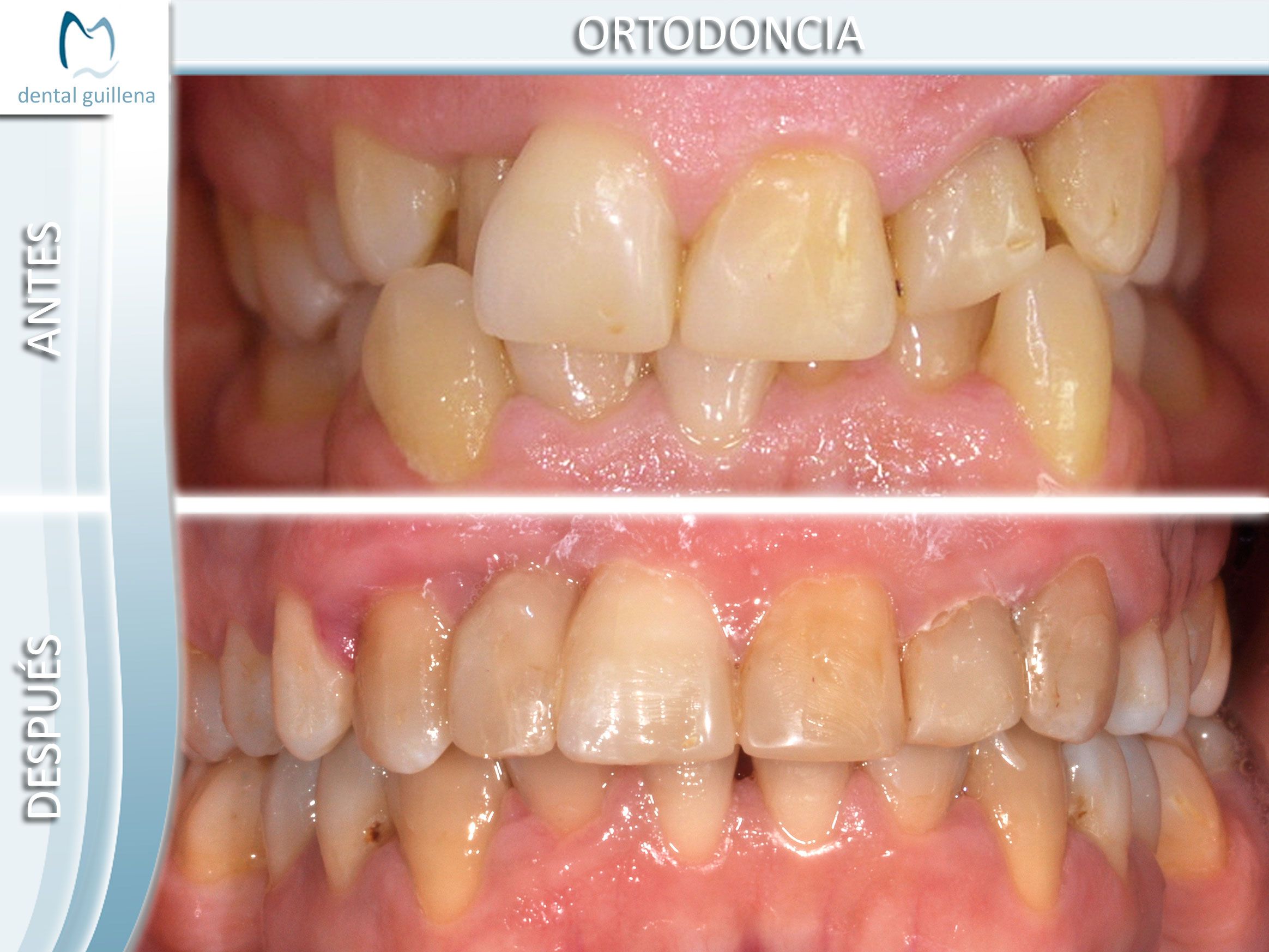 Ortodoncia 5