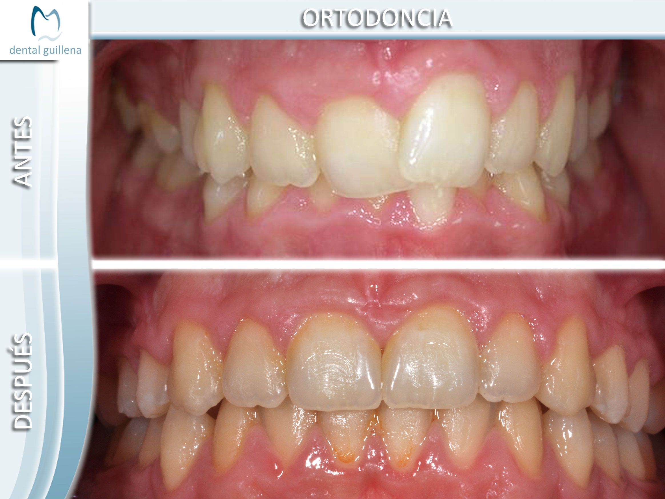 Ortodoncia 6