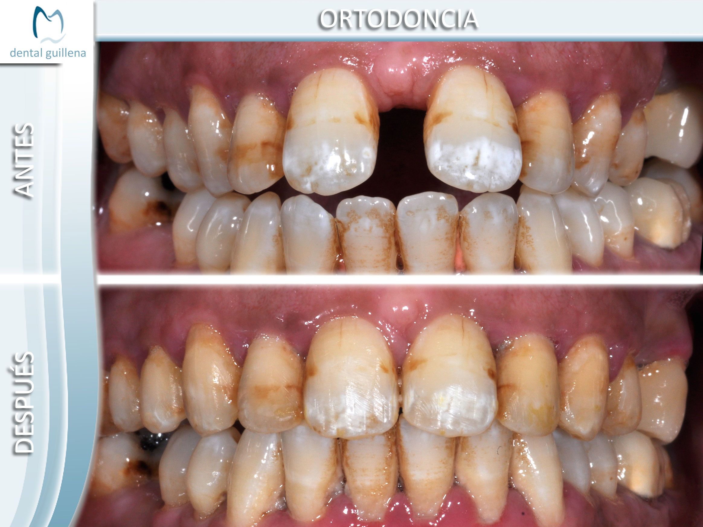 Ortodoncia 7
